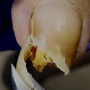 Nail Shot