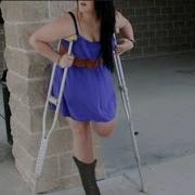 Amputee Woman One Leg Heel Crutches And Stump