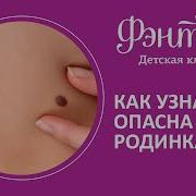 Родинка