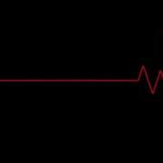 Rising Heartbeat Sound Effect