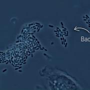 Eat S Cells